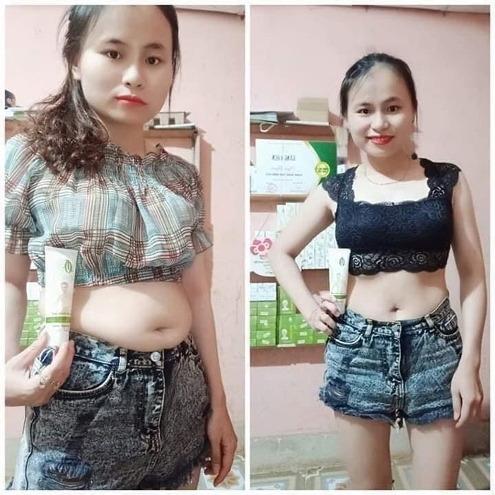 kem tan mo olic anh 001